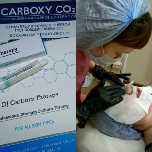 karboksiterapiya-carboxy-co2-dlya-litsa-i-shei-neinvazivnoe-reshenie-esteticheskikh-problem