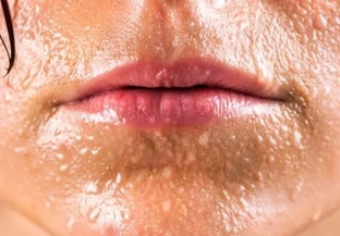 kharakternye-simptomy-i-osnovnye-prichiny-gipergidroza-litsa