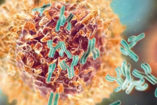 klinicheskij-sluchaj-slozhnoj-diagnostiki-t-kletochnoj-limfomy-kozhi-chast-2