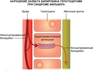 kogda-zheltushnost-kozhi-ne-trebuet-lecheniya