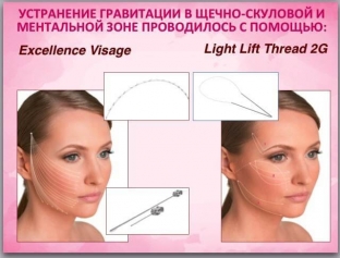 korrektsiya-vozrastnykh-izmenenij-zhenskogo-litsa-v-premenopauze-sovety-professionala