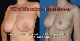 krasivaya-grud---eto-sochetanie-khoroshej-formy-dostatochnogo-ob-ema-i-proportsionalnosti