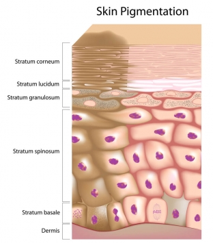lazernoe-udalenie-giperpigmentatsii-kakoj-tip-protsedury-predpochest