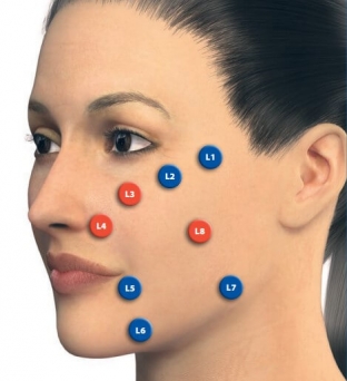 lifting-litsa-s-preparatami-juv-derm-volumatm-i-juv-derm-volifttm-rukovodstvo-dlya-spetsialistov