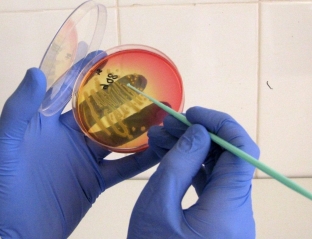 metody-diagnostiki-khlamidioza-preimushchestva-i-nedostatki