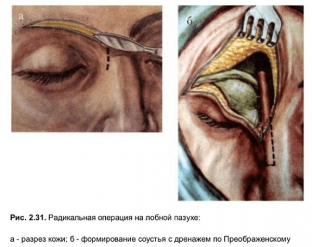 metody-effektivnogo-lecheniya-khronicheskogo-frontita