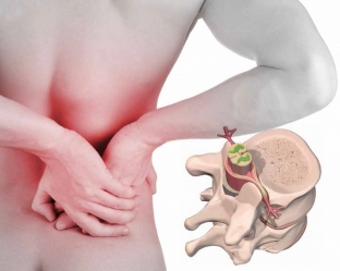 mezhpozvonochnaya-gryzha-simptomy-i-lechenie-opasnogo-narusheniya
