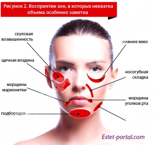 nevidimaya-bezoperatsionnaya-podtyazhka-litsa-dlya-ustraneniya-priznakov-stareniya