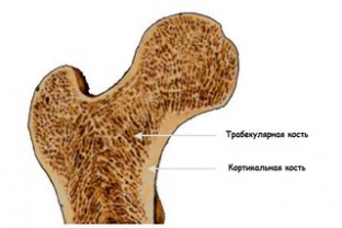 novyj-metod-rannej-diagnostiki-osteoporoza-kosti