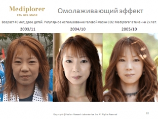 omolazhivayushchij-effekt-neinvazivnoj-karboksiterapii-mediplorer-yaponiya