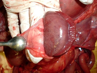 opasnyj-perinefrit-simptomy-i-lechenie-vospaleniya-kapsuly-pochki