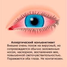 osnovnye-formy-i-simptomy-allergicheskogo-kon-yunktivita