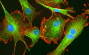 osnovy-kosmetologii-chto-my-znaem-o-fibroblastakh