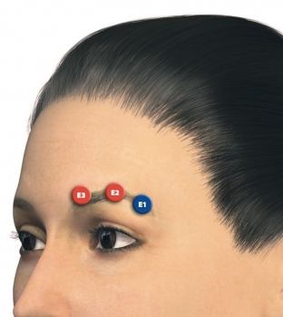 osobennosti-protsedury-modelirovaniya-brovej-s-preparatom-juv-derm-volift-tm