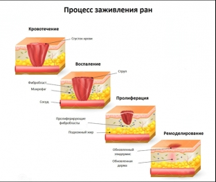 osobennosti-zazhivleniya-ran-na-kozhe-v-esteticheskoj-khirurgii