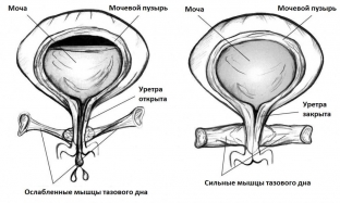 pochemu-voznikaet-nederzhanie-mochi