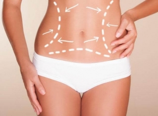 poluchit-krasivyj-zhivot-bez-usilij-pomozhet-operatsiya-abdominoplastika