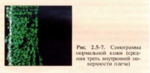 povrezhdeniya-tkanej-pod-vozdejstviem-sveta-i-instrumentalnaya-diagnostika-sostoyaniya-kozhnykh-pokrovov