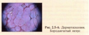povrezhdeniya-tkanej-pod-vozdejstviem-sveta-i-instrumentalnaya-diagnostika-sostoyaniya-kozhnykh-pokrovov