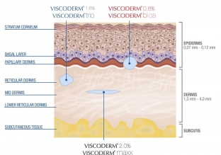 preparat-viscoderm---vybor-professionalov-dlya-biorestrukturizatsii-kozhi