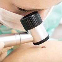 prichiny-rodimykh-pyaten-i-metody-ikh-diagnostiki