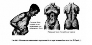 raspoznat-opasnost-simptomy-zhelchnokamennoj-bolezni