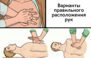 rasprostranennye-oshibki-pri-okazanii-pervoj-pomoshchi