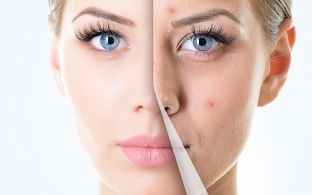 samye-rasprostranennye-problemy-i-zashchita-kozhi-letom-sovety-dermatologov