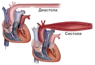 simptomy-gipertonicheskogo-kriza-kak-predotvratit-katastrofu