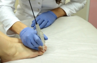 simptomy-lechenie-i-profilaktika-gribka-nogtej