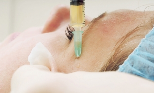 steret-starost-s-litsa-osobennosti-biorevitalizatsiya-posle-50-let