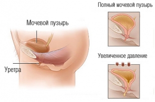 stressovoe-nederzhanie-mochi-problema-o-kotoroj-zhenshchiny-ne-khotyat-govorit