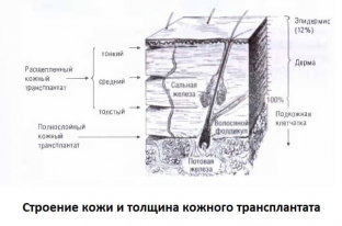 transplantologiya-v-plasticheskoj-khirurgii-vidy-transplantatov
