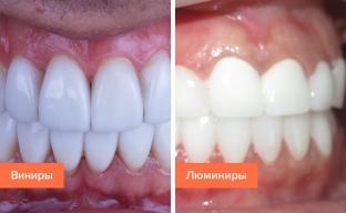 viniry-i-lyuminiry-preimushchestva-nedostatki-i-osnovnye-razlichiya