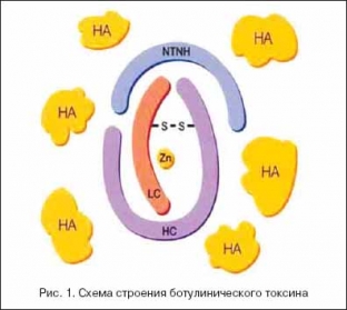 vozmozhnosti-i-perspektivy-ispolzovaniya-botulotoksina-v-klinicheskoj-praktike