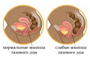 vumbilding-kratchajshij-put-k-intimnomu-zdorovyu-i-potryasayushchemu-seksu